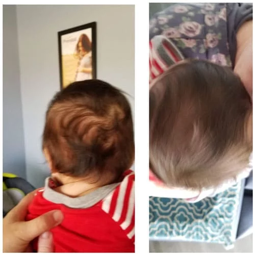 Hair Growth in Simi Valley CA