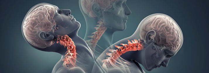 Chiropractic Los Angeles CA Personal Injury